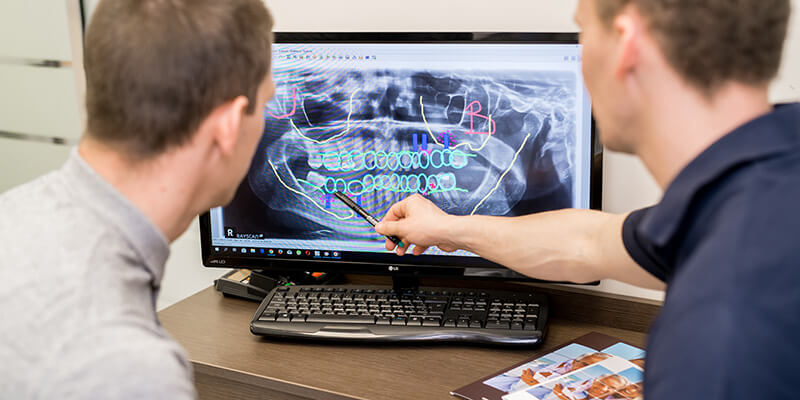 Die unterschiedliche Arten der Inlays