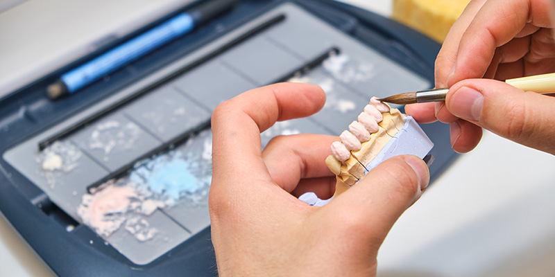 Bekannte Hersteller der Implantate